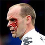 Danny Murphy